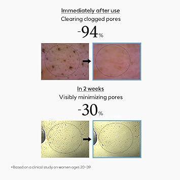 Hanyul Chestnut Shell Pore Clearing Clay Mask 100ml - Image 8