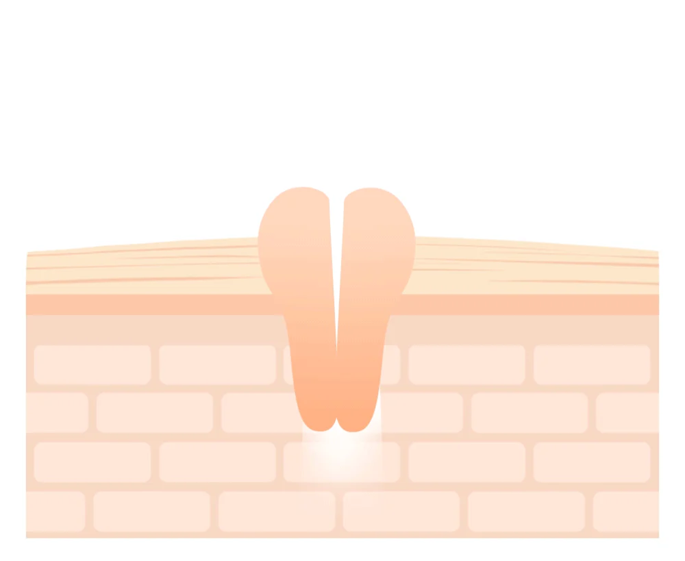 Needly Crossbarrier Mask 30 sheets - Image 10