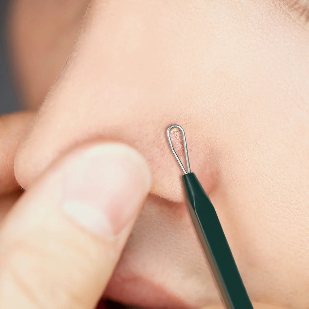 PyunkangYul Pimple Extractor - Image 4