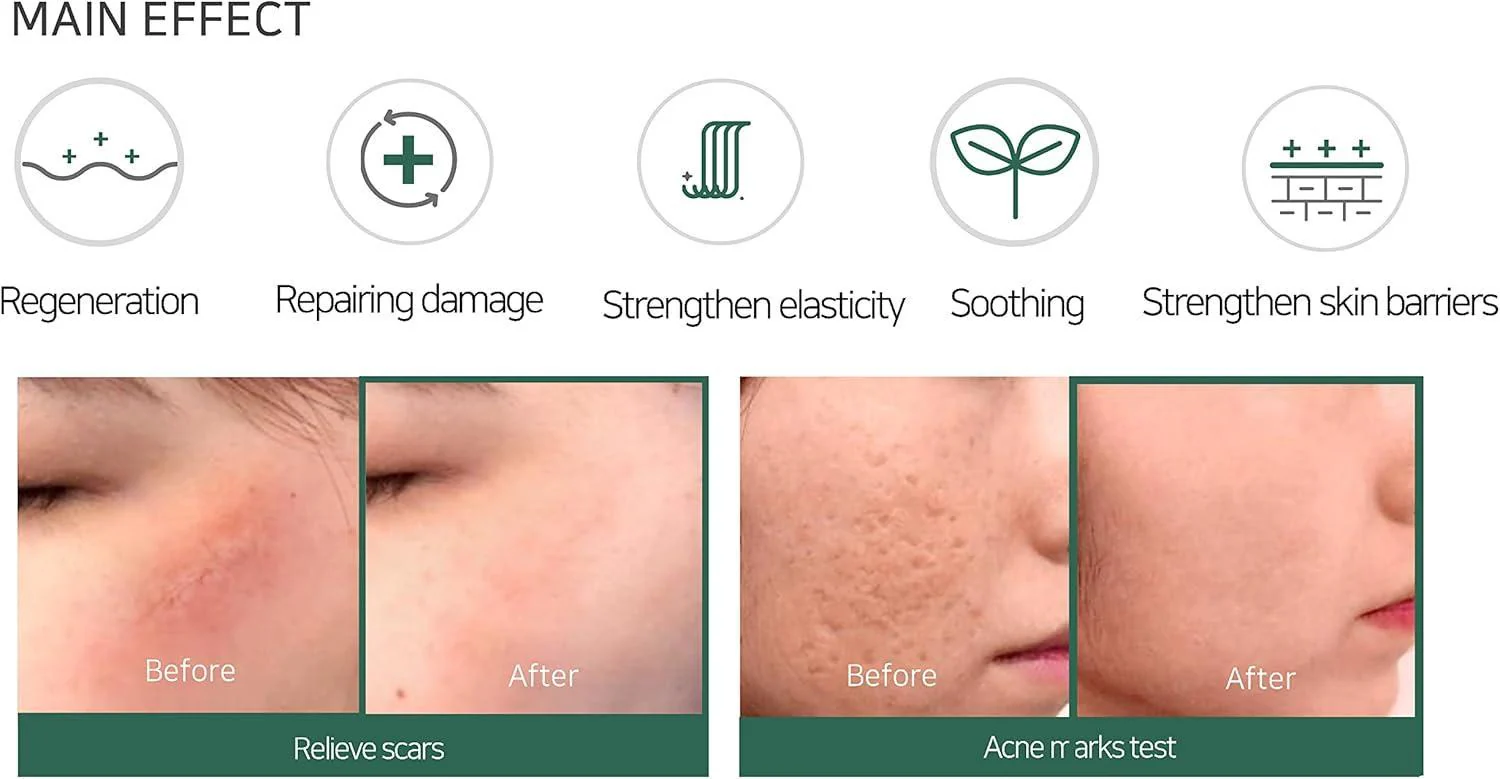 SomeByMi AHA-BHA-PHA 30DAYS MIRACLE CREAM 60g - Image 10