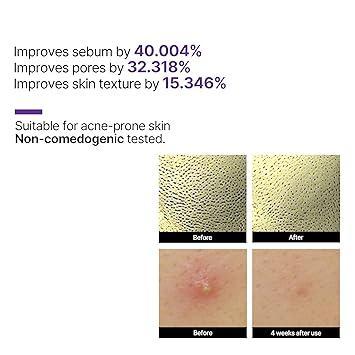 SomeByMi Retinol Intense Reactivating Serum 30ml - Image 6